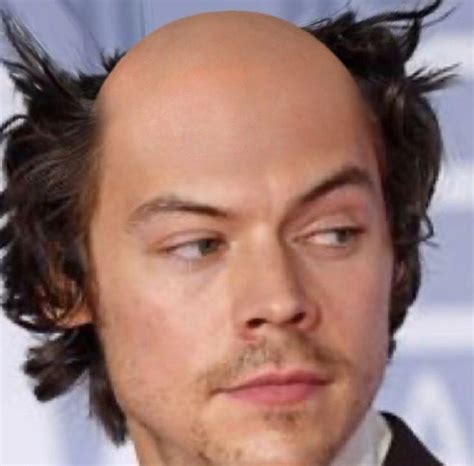 harry styles bald real